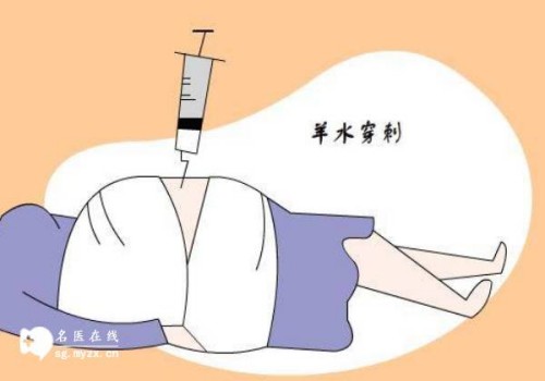 杭州供卵代生：﻿卵巢早衰的症状都有什么，这些卵巢早衰的早期信号女性看仔细了！